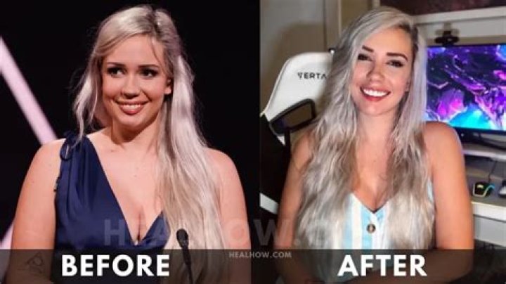 Alanah Pearce Surgery: Before And After Photos