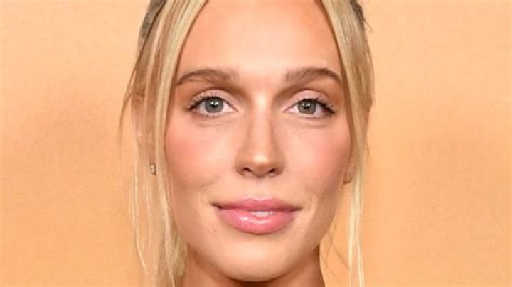 Alex Cooper Admits to Getting Botox — Reveals Why She Could Never Get Implants