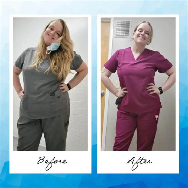 Hello Tomorrow Cast Alison Pill Weight Loss Journey: Before And After Photo