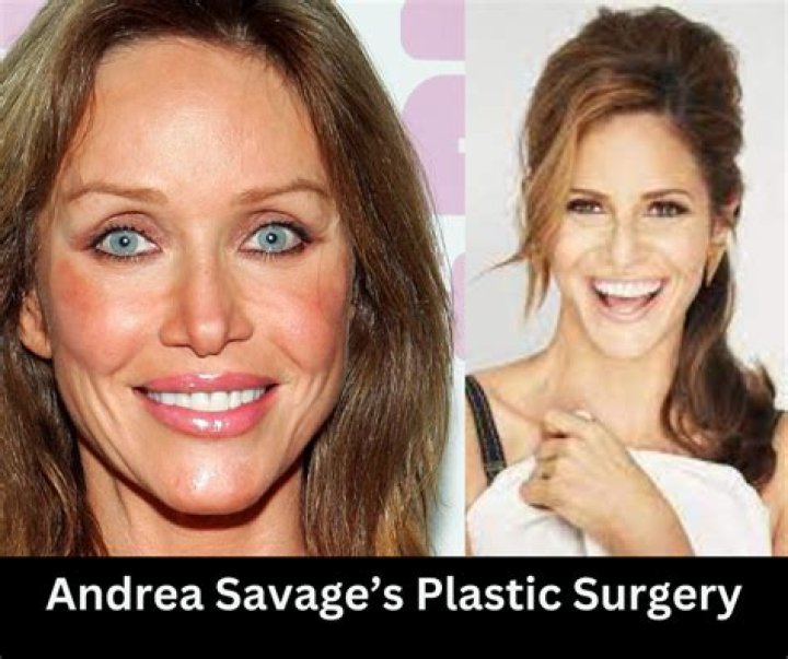 Andrea Savage Plastic Surgery: Before And After Photo
