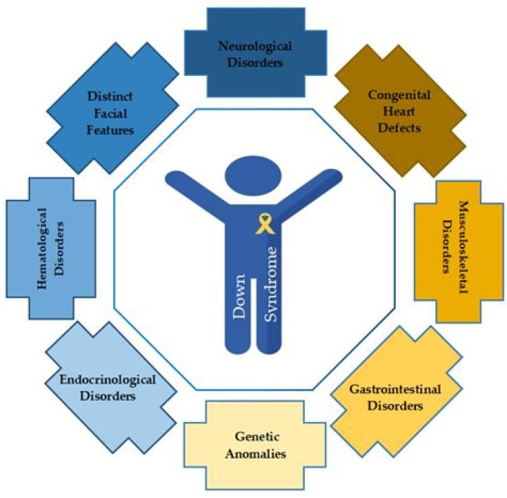 Boxer Danny Mardell Wikipedia: Age And Down Syndrome Diagnosis