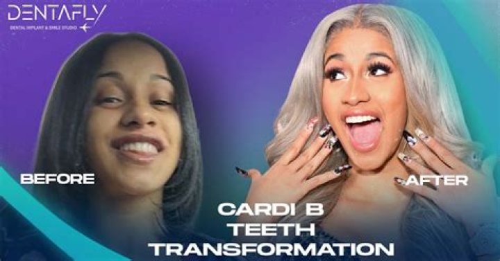 Cardi B's Teeth Transformation — A Complete Breakdown