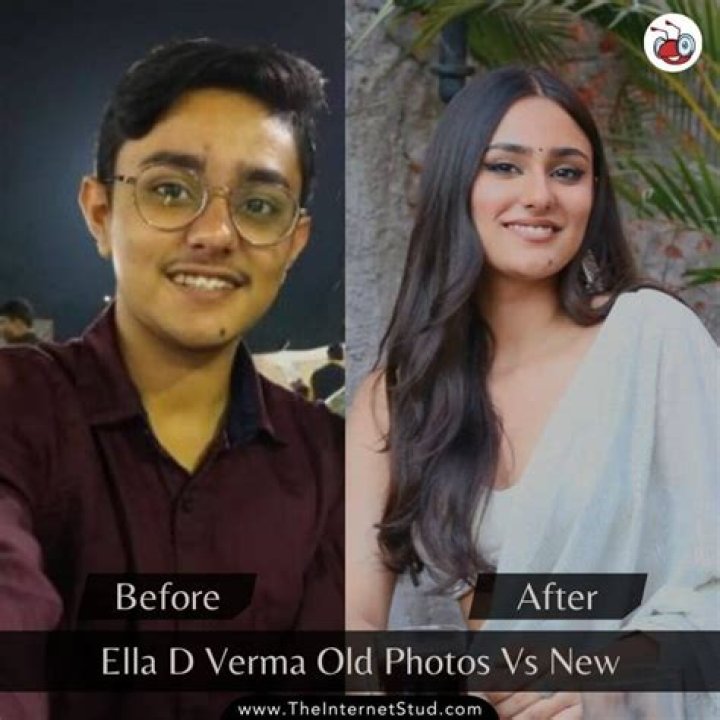 Ella D Verma Before And After: Did She Get A Surgery?