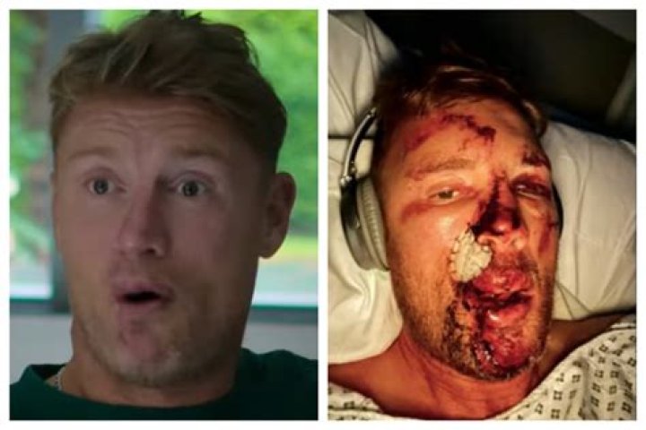 Freddie Flintoff Accident: Is He Still In Hospital? Surgery And Health Update