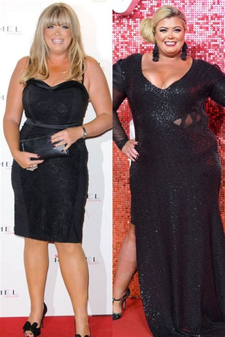 A Look at Gemma Collins’ Magnificent Weight Loss Journey