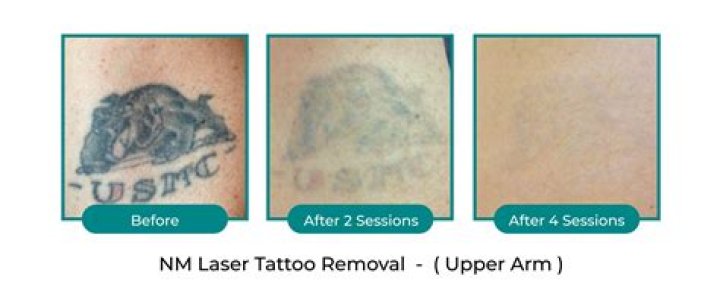 How Many Tattoo Does Rachel Daly Have? Meaning And Design