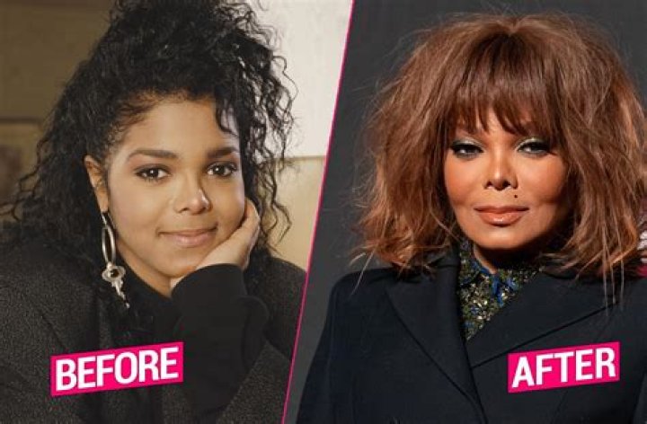 Here’s What Janet Jackson Has Said about Her Plastic Surgery