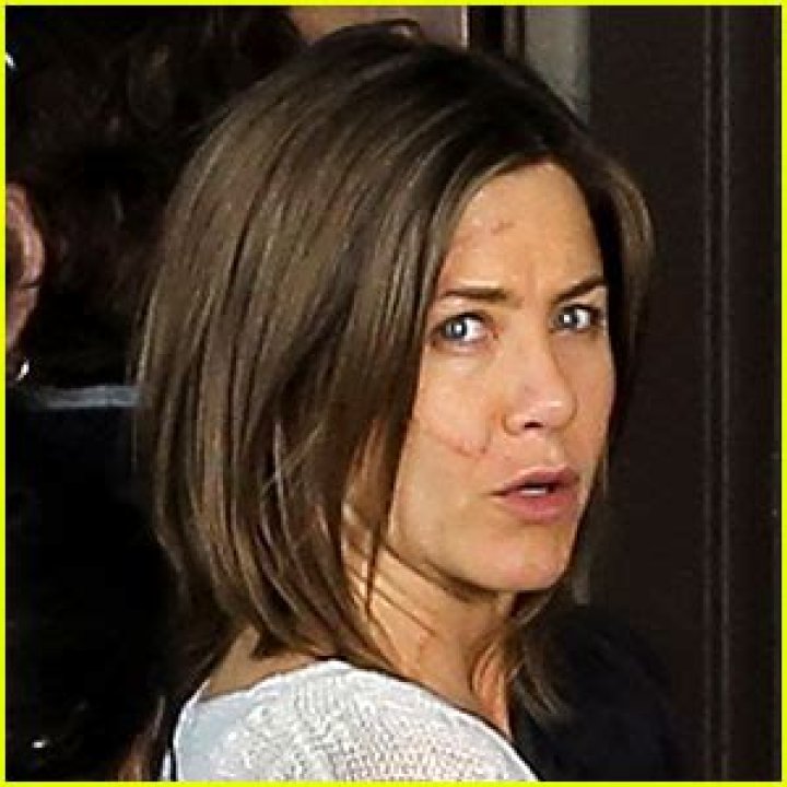 Truth Behind Jennifer Aniston's Face Scar & No-make Up Look