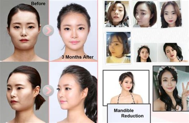 Kim Lim Before And After Photos: Plastic Surgery Transformation