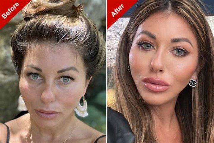 Michelle Dee No Makeup Look: Plastic Surgery Before After