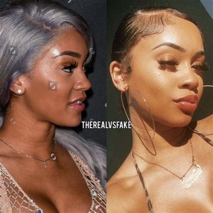 Nikita Dragun Bottom Surgery: Before And After Photos