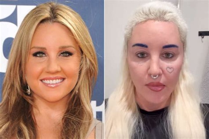 Nikki Tamboli Plastic Surgery Before and After
