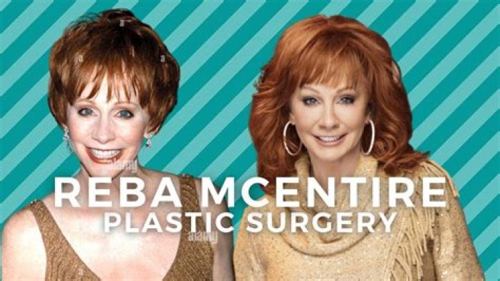 Reasons Behind Reba Mcentire Lips: Plastic Surgery