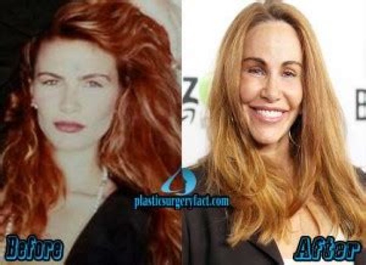 Tawny Kitaen Said She Got Plastic Surgery Due to Insecurities