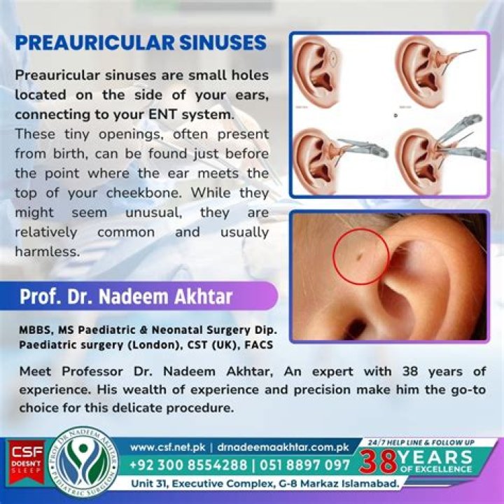 People Are Learning the Tiny Holes Above Their Ears Can Be Explained by Evolution