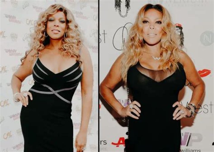 Before Surgery and after — A Look at How Wendy Williams's Appearance Has Evolved over the Years