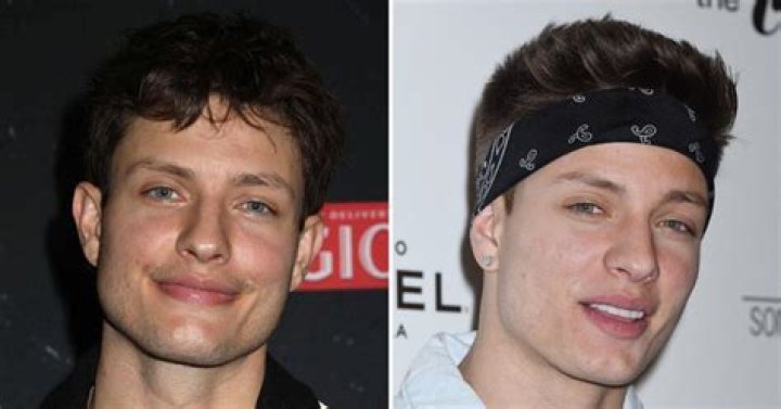 What Happened To Matt Rife Face? Illness And Disease