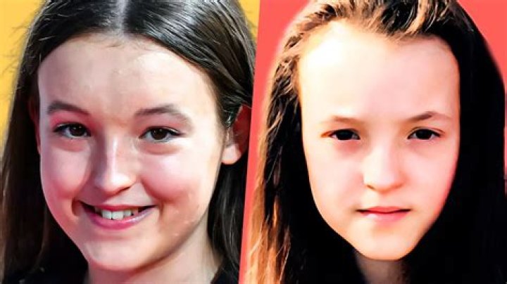 What Is Wrong With Bella Ramsey Teeth?